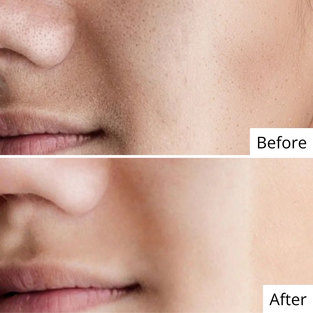 Deep Nourishing Cream