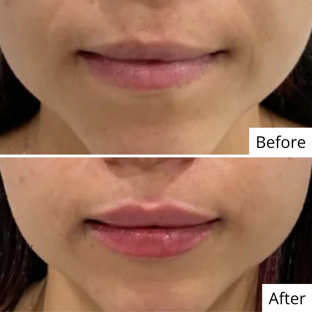 Deep Hydrating Regime for Dry Skin