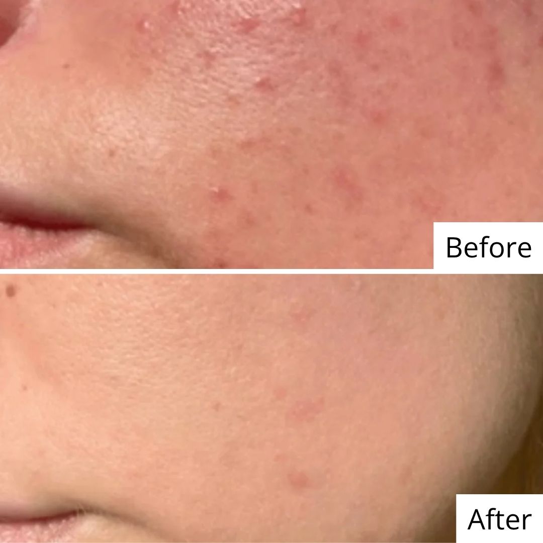 Pore Refining Serum
