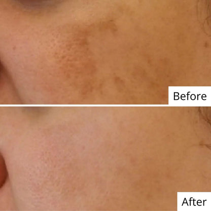 Vit C Brightening Serum