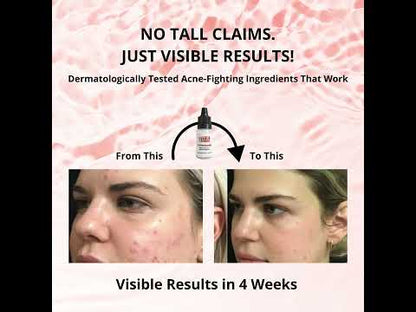 Pore Refining Serum